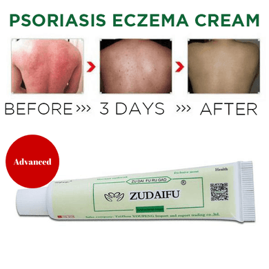 Advanced Psoriasis & Eczema Cream